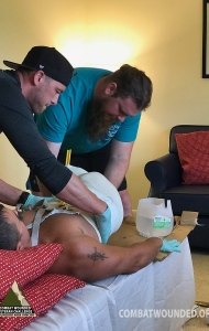 SCUBA Challenge Prosthetic Fin Casting